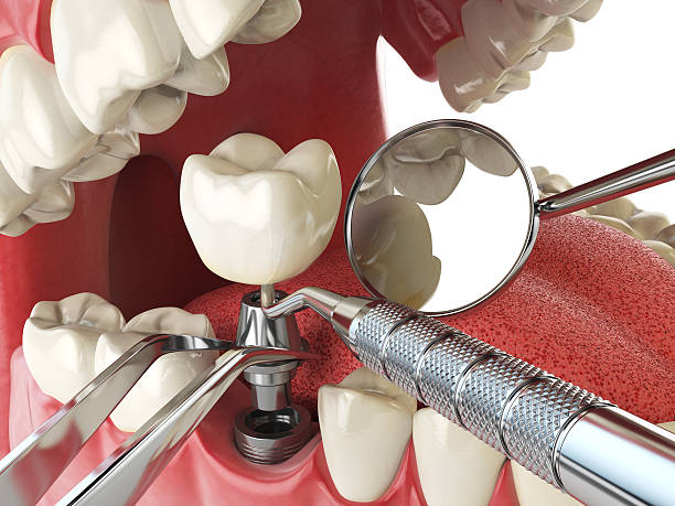 Best Orthodontic Emergency Dentist in Maryville, MO